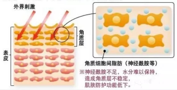 神經(jīng)酰胺的防敏放刺激作用