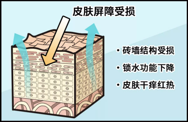 皮膚屏障受損后應該如何修護？